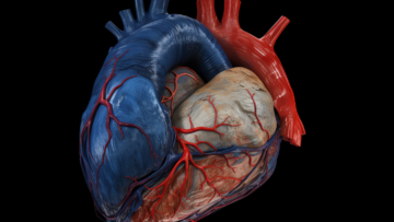 alekkks_An_accurate_representation_of_pericardial_effusion_port_57ad6a6f-3339-4e16-8464-b6d46a866dd1