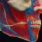 alekkks_Detailed_3D_visualization_of_a_nasal_fracture_featuring_18731b93-8363-4d18-9b19-50b40c7c5407