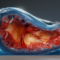 alekkks_Photorealistic_capture_of_stable_and_unstable_angina_sh_ec0e5d39-067c-4a1a-98bd-96899fc299bc