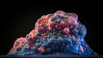 alekkks_Photorealistic_depiction_of_Benign_Breast_Pathology_sho_96dc4d7a-3aa8-4214-965f-e1181526bdd3