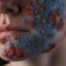 alekkks_Photorealistic_depiction_of_Pyoderma_showcasing_the_cha_383582eb-f44b-474d-b889-900c9fce7d7d