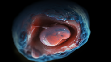 alekkks_Photorealistic_depiction_of_Rupture_of_Membranes_showca_e285469b-de20-4e94-bae2-6a2442bb7c7c